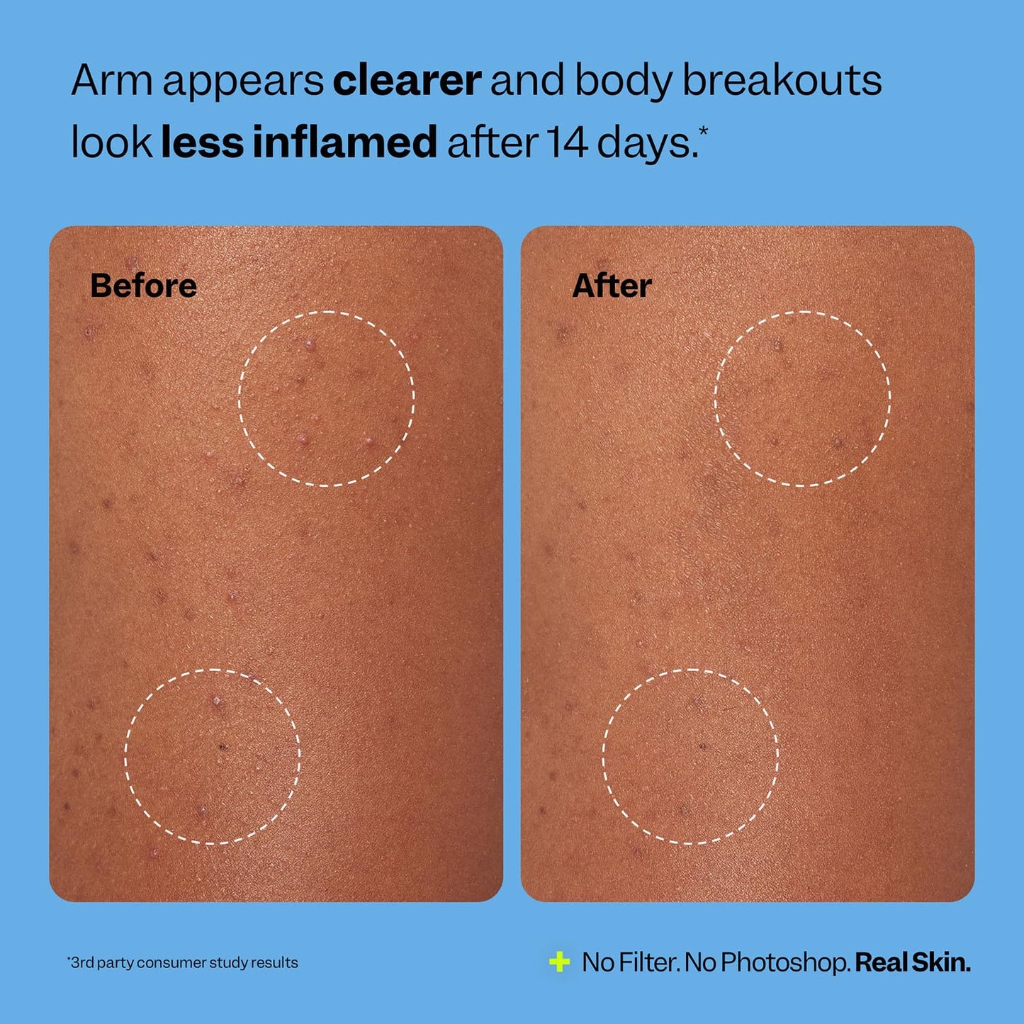 Peach Slices Body Breakout Patches