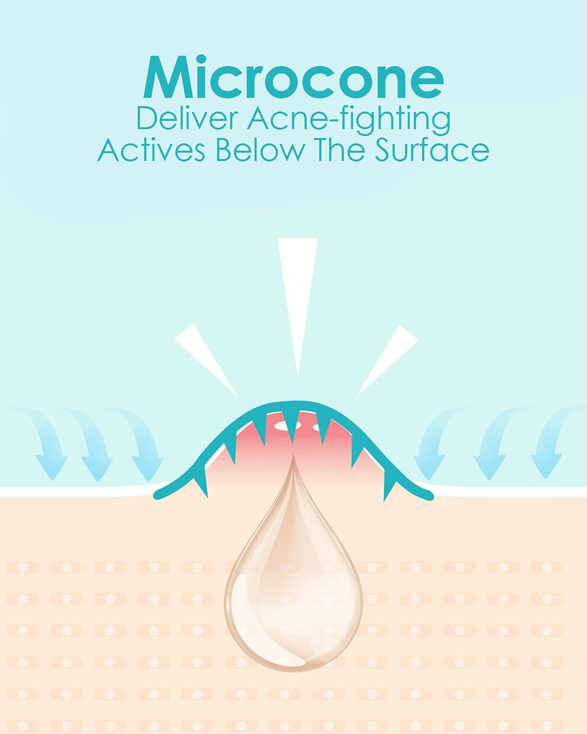 Microdart Acne Patch (9 Patches) - Hyaluronic Acid & Salicylic Acid Hydrocolloid Pimple Patch for Deep, Early and Hidden Blemishes (9 Count (Pack of 1))