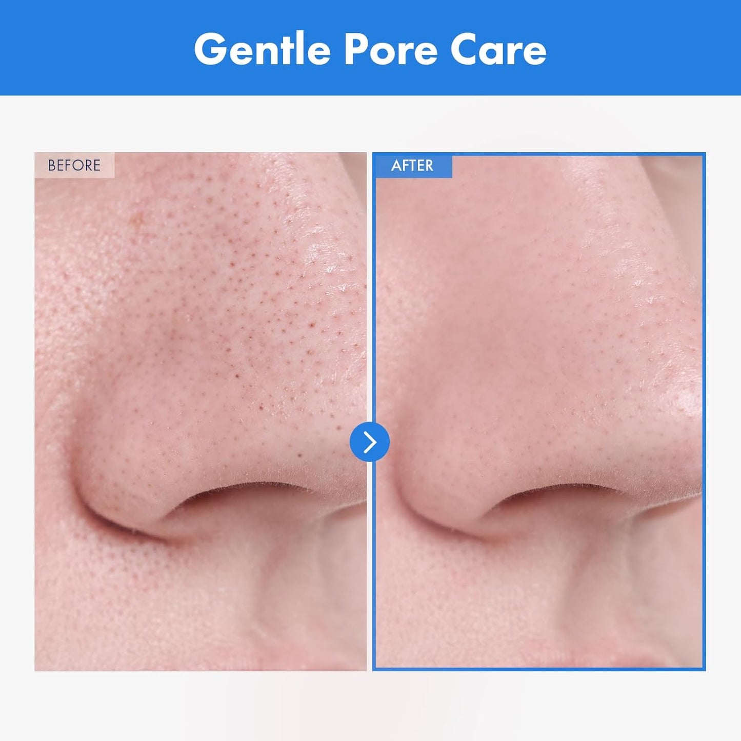 AHA Deep Cleansing Facial Oil with Jojoba Oil, Tea Tree Oil, PHA and Centella Asiatica, Korean Blackhead Remover, Pore Cleaner and Sebum Remover, 145ml, 4.9 fl. oz.