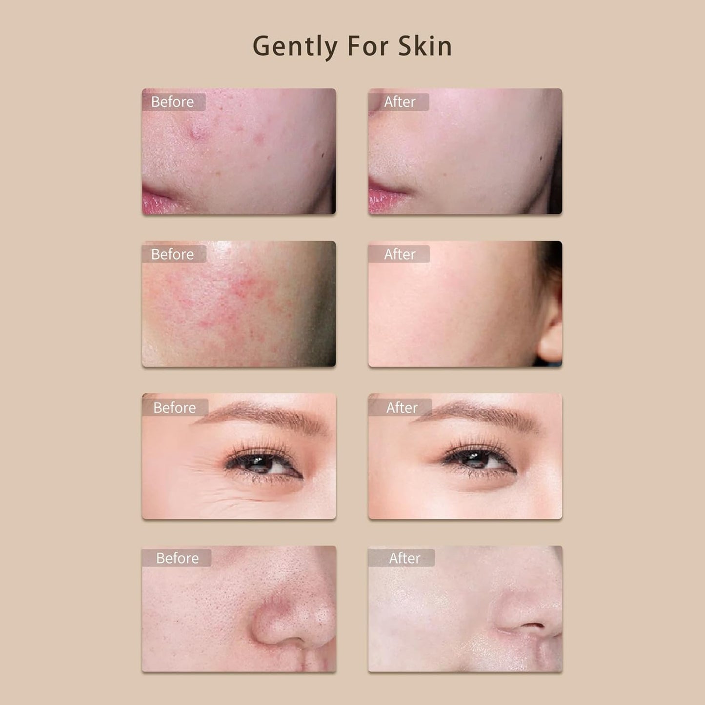 Red Light Therapy for Face Four Colors Portable Led Facial Mask Light Therapy with Remote LED Skincare Devices with Timing Function Beauty Mask led face mask Care for Home and Travel - Pink