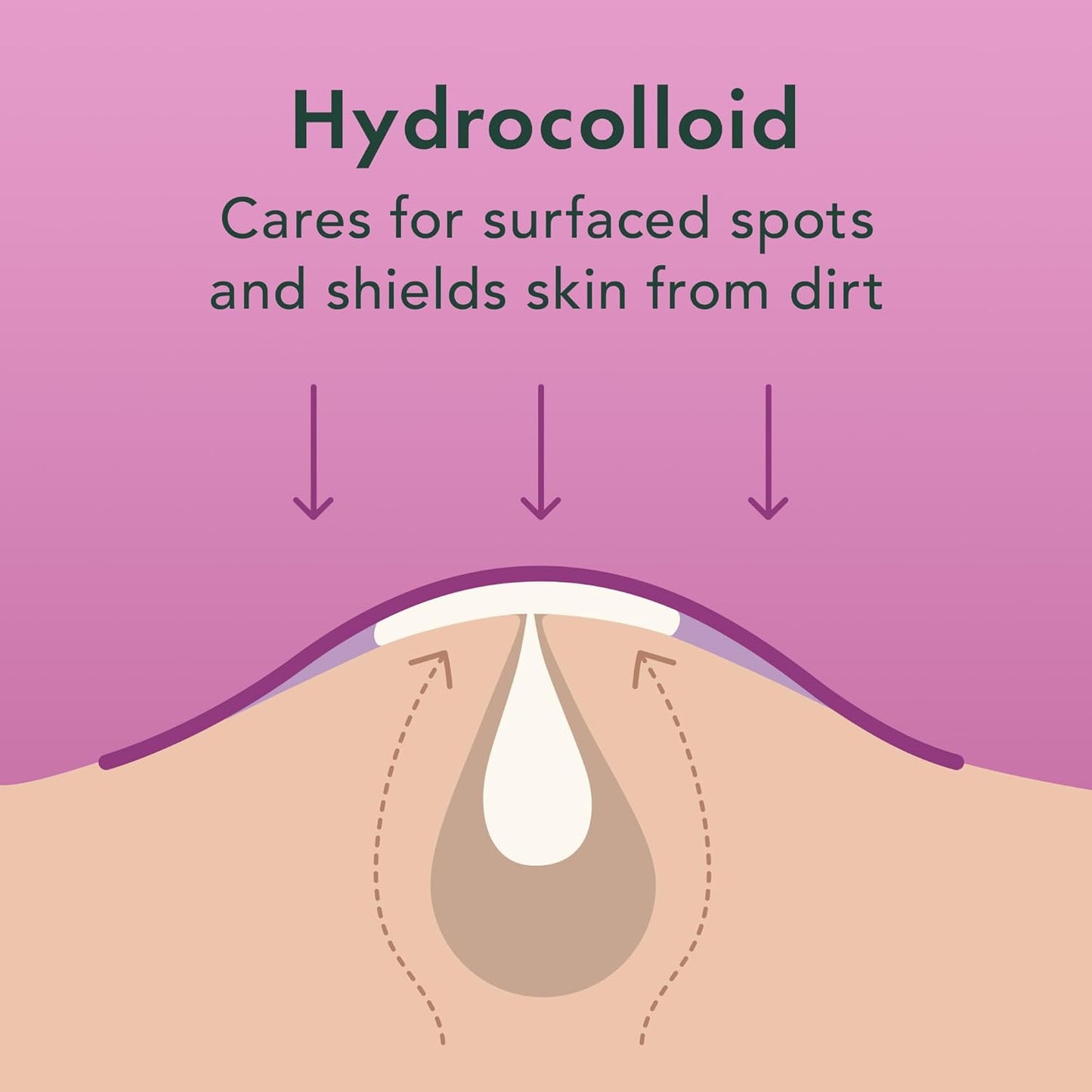 Rael Pimple Patches - Miracle Overnight Spot Cover, Thicker & Extra Adhesion, Hydrocolloid Acne Treatment for Face, Zits & Blemishes, Korean Skin Care, Vegan & Cruelty-Free, 3 Sizes (104 Count)