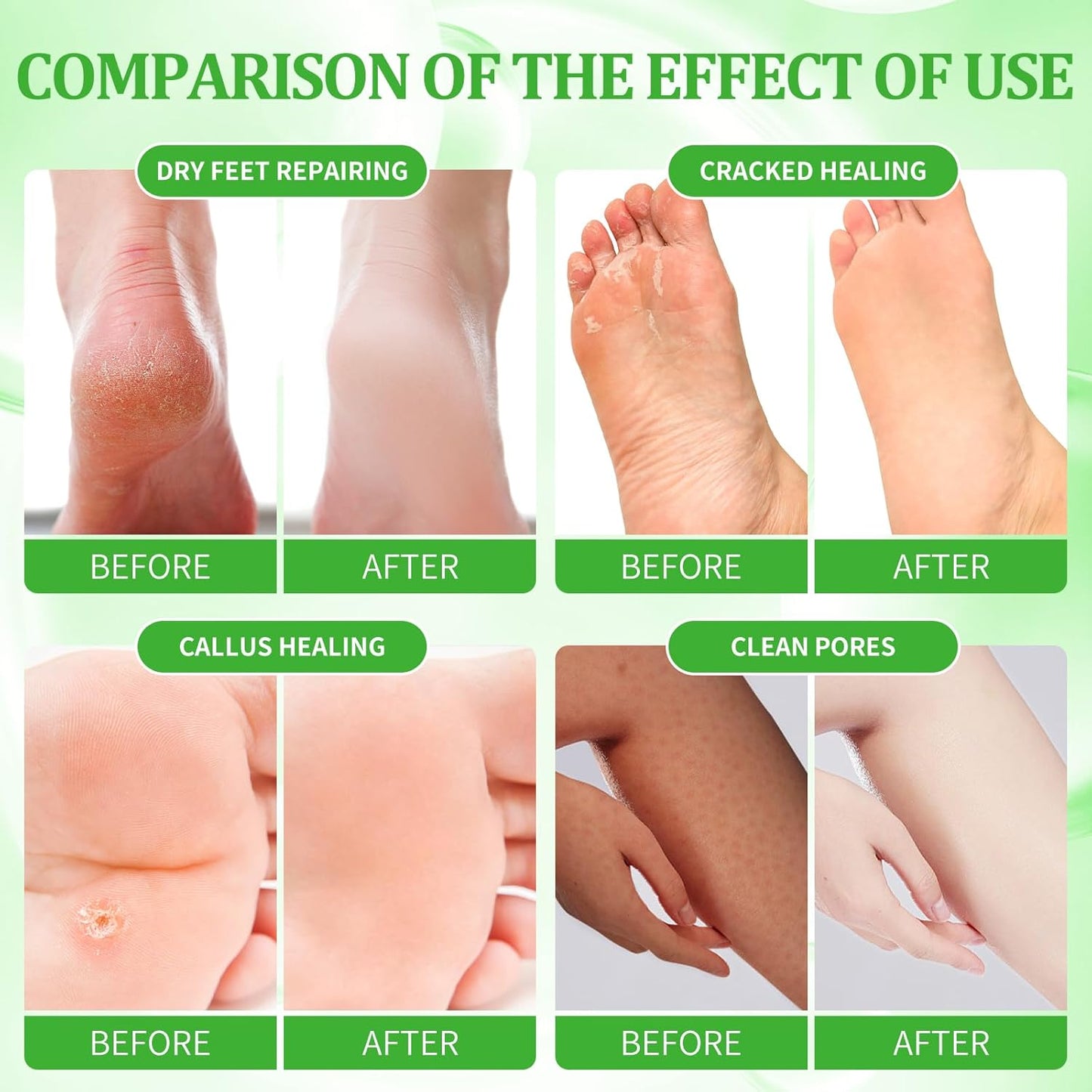 Pedicure Kit Foot Soak Set: Bubble Salt, Sugar Scrub, Massage Mask, Massage Lotion in a Box, 4 Step Foot Spa Kit for Dry Feet, Calluses and Tired Feet(3 Set Lemon)