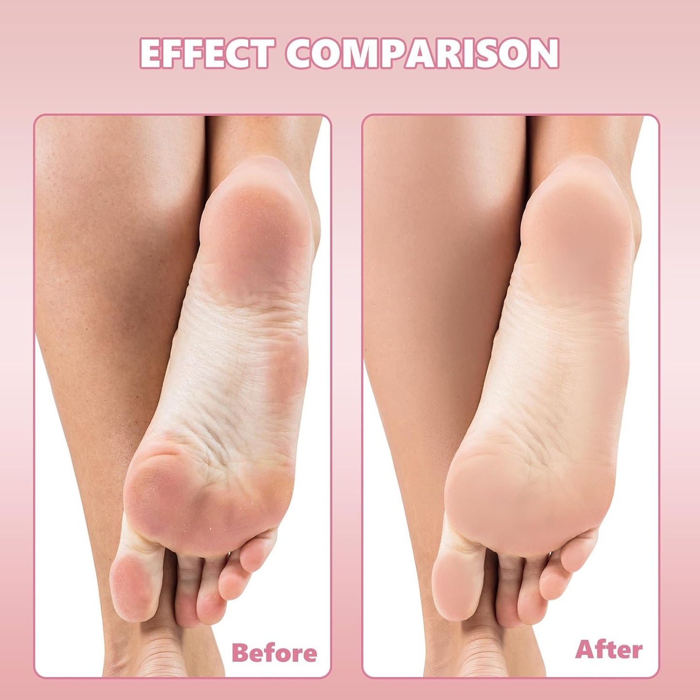 Flutesan 80 Pcs Stainless Steel Foot File Refills 180 Grit Replacement Pads Coarse Fine Pedicure File Refills Double Side Reusable Foot Rasp Pad with Removable Glue