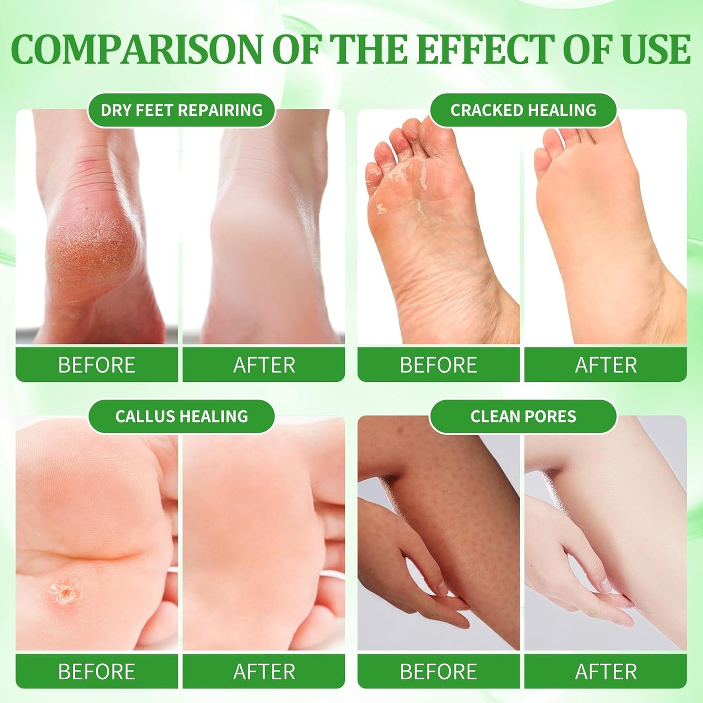 Pedicure Kit Foot Soak Set: Bubble Salt, Sugar Scrub, Massage Mask, Massage Lotion in a Box, 4 Step Foot Spa Kit for Dry Feet, Calluses and Tired Feet(3 Set Olive)