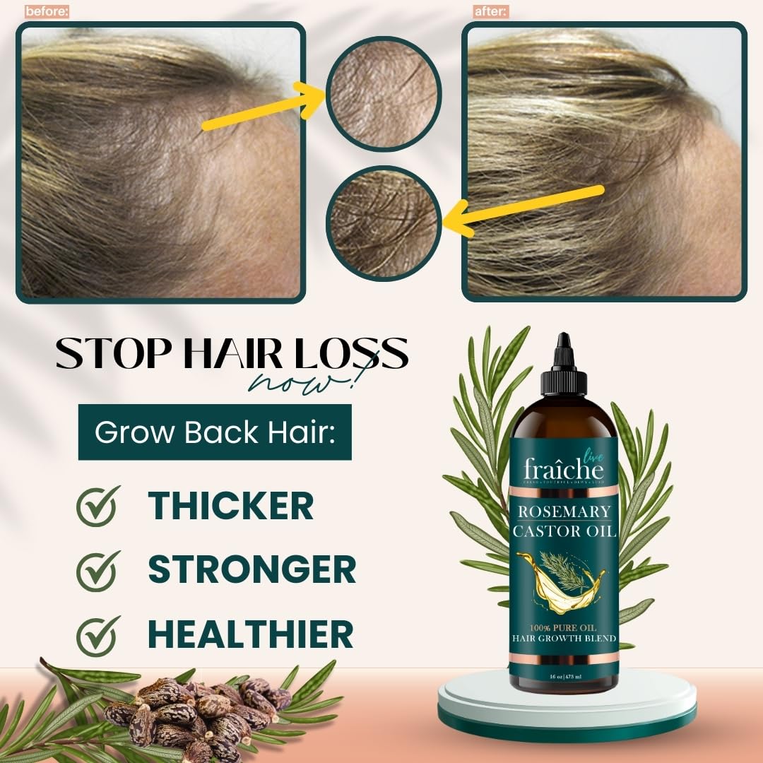 Live Fraiche Rosemary Castor Oil for Hair Growth 16oz - Rosemary Oil for Hair Growth and Thickening Pure Blend to Reduce Loss and Promote a Healthy Scalp