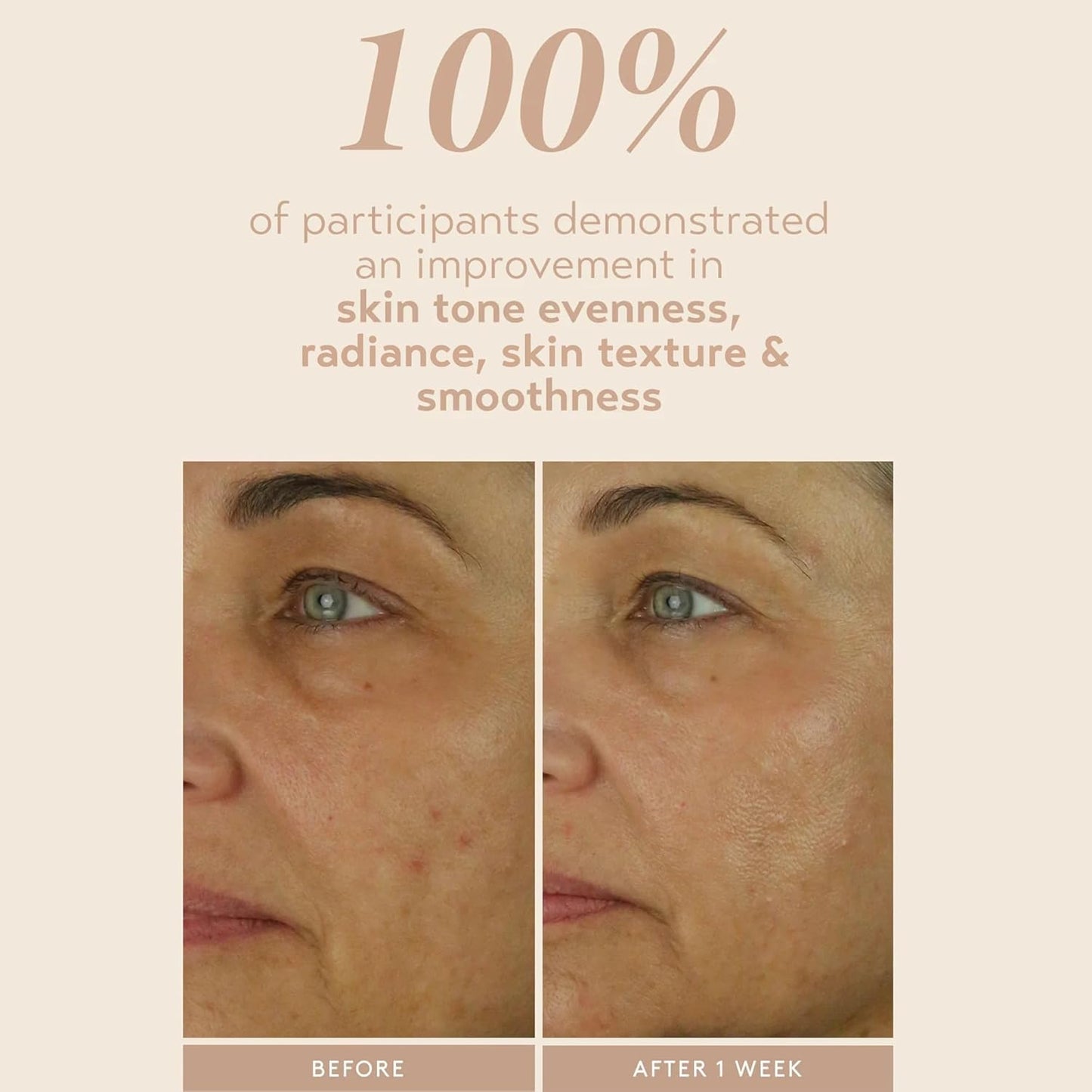 SHANI DARDEN SKIN CARE Retinol Reform with 1% Encapsulated Retinol Serum for Face & Neck, Gentle Slow-Release Retinol Face Serum with Tripeptide for Wrinkles, Fine Lines & Uneven Tone, 0.3 fl oz