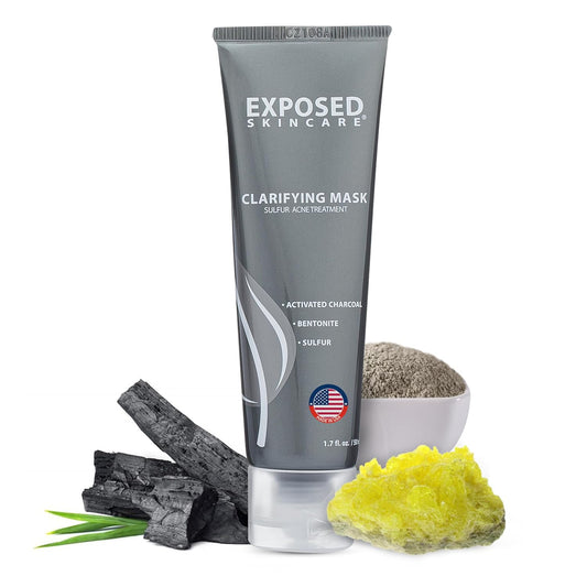 Exposed Skin Care Activated Charcoal Face Mask to Purify Skin, Regulate Oil Production and Visibly Minimize Pores – Clarifying Acne Treatment Mask with Bentonite and Sulfur (1.7 Fl. Oz.)