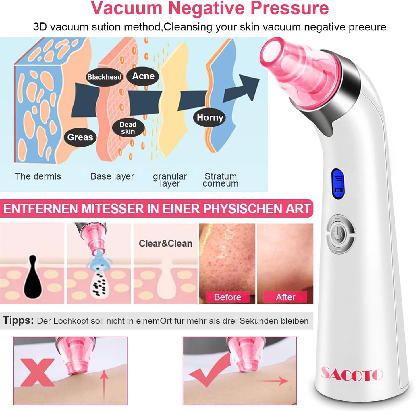 Blackhead Remover Pore Vacuum, Face Suction Pore Cleanser, 5 Suction Power Electric Blackhead Extractor Tool, 4 Probes, Blackhead Suction Remover for Women & Men (Pink)