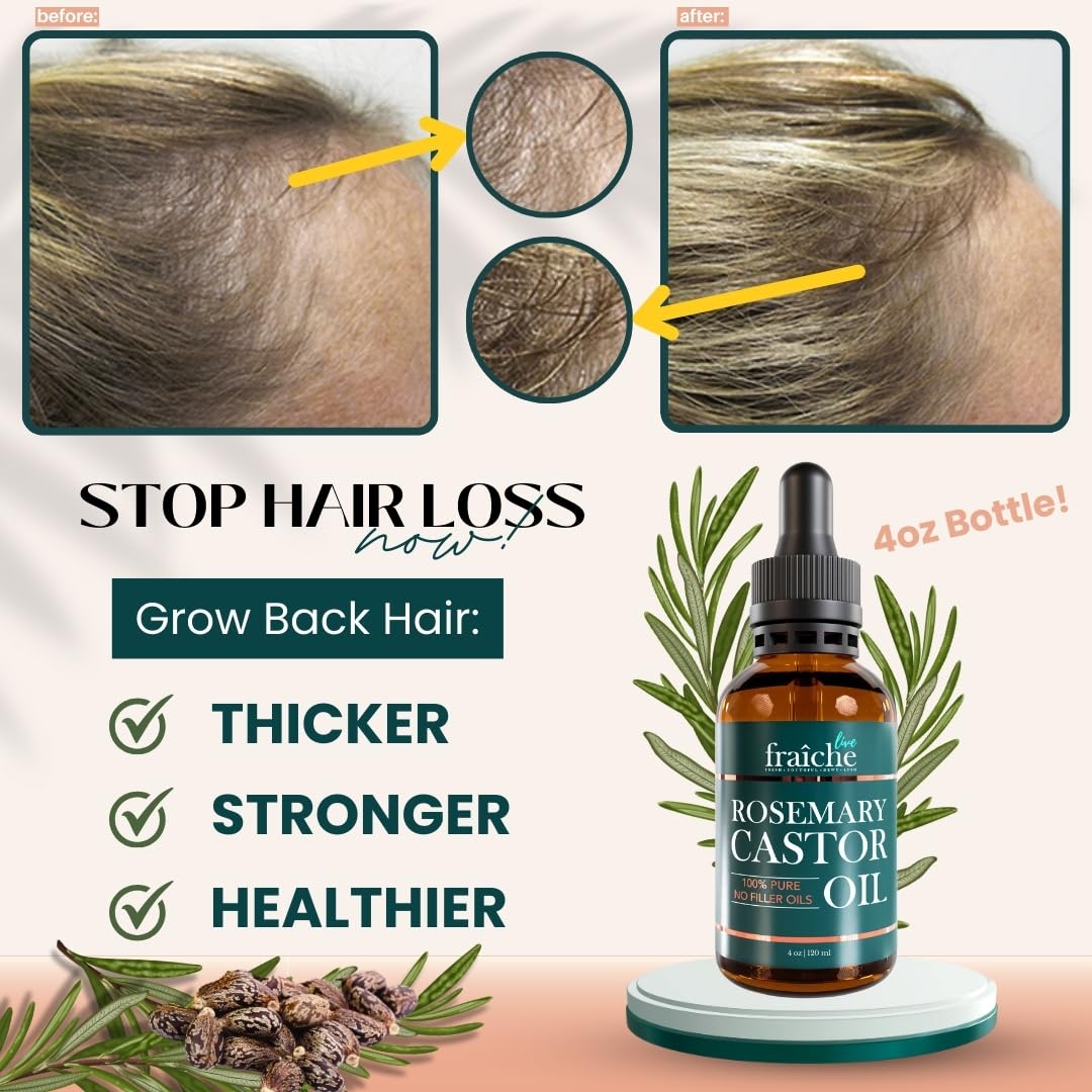 Live Fraiche Rosemary Castor Oil for Hair Growth 4 Ounce - Cold Pressed Castor Oil and Rosemary Oil for Damaged Hair to Reduce Hair Loss