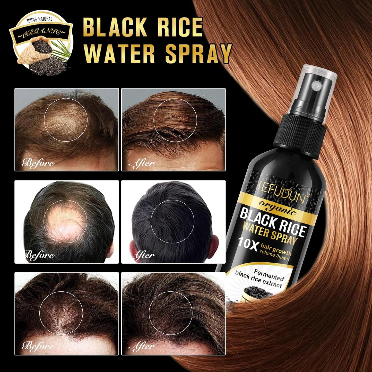 (3Pc) Organic Black Rice Water Spray for Hair Growth, A Solution with Castor Oil & Ginger Root Extract for Thicker, Fuller Hair, Targets Hair Loss and Repairs Damage 300ml/9.6 fl.oz