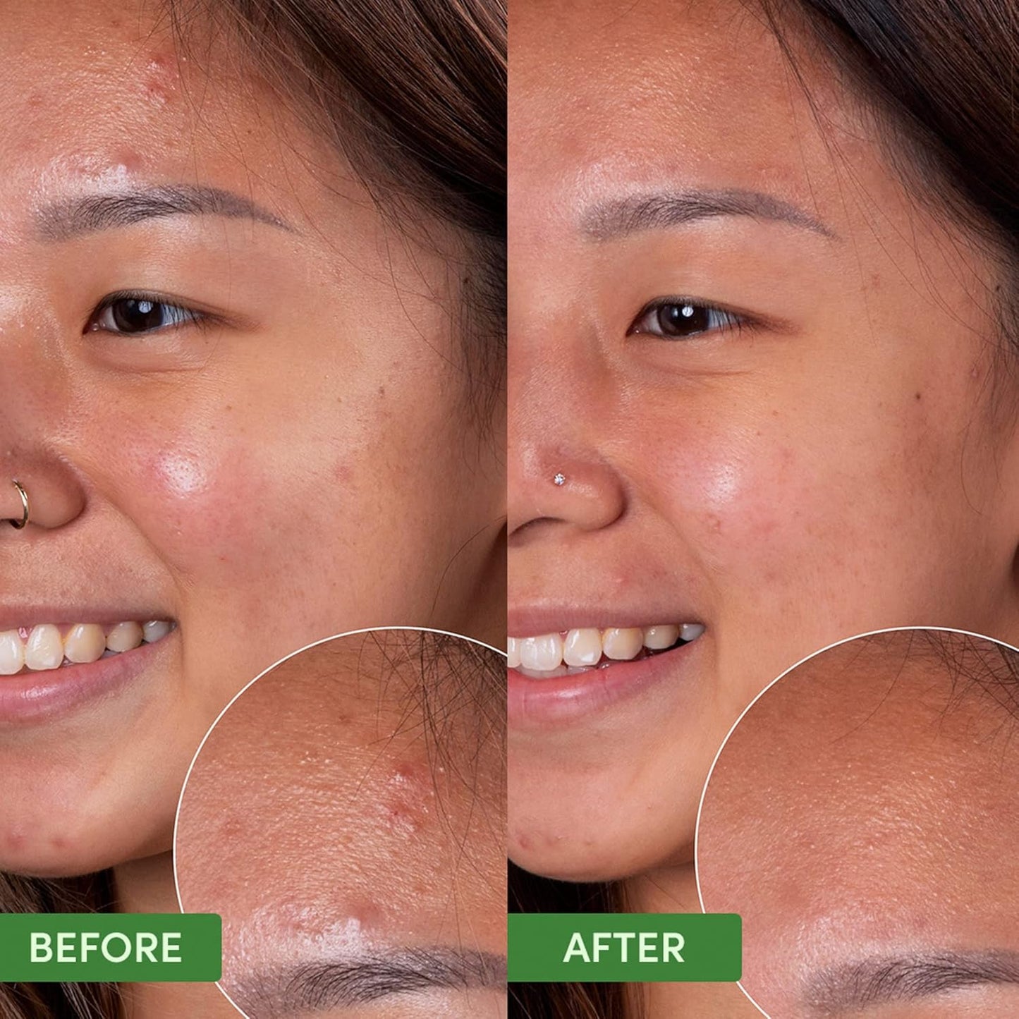 Sand & Sky Oil Control Gentle Face Cleanser with AHA & BHA - pH-Balanced Blemish Cleanser, Reduces Redness, For Oily Skin & Breakouts, 4.2 fl oz